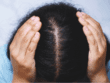 Can Stress Affect Hair Growth