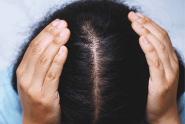 Best Castor Oil For Hair Growth